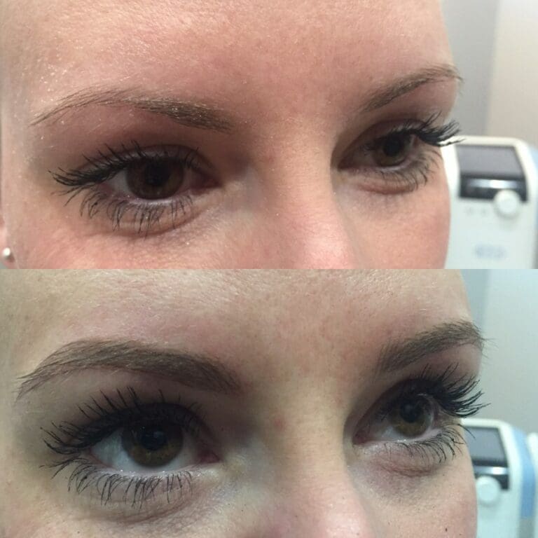Blue Halo Med Spa - Eyebrow Microblading - Before and After
